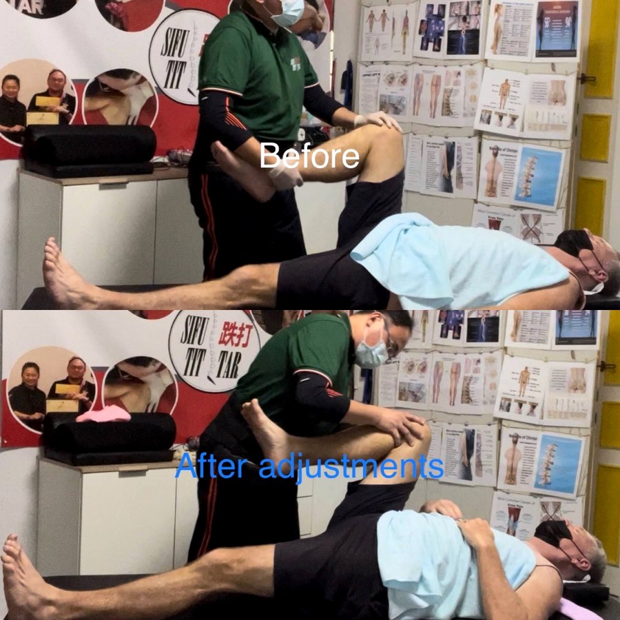 Straight leg raise before and after tit tar bone setting adjustment at SIFU TIT TAR Singapore