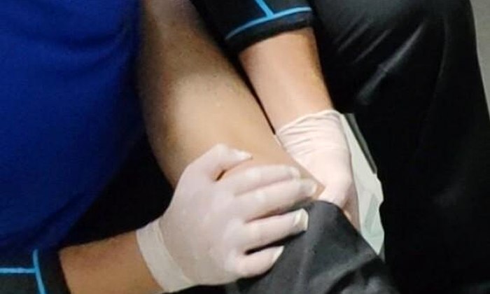 Knee treatment at SIFU TIT TAR Singapore
