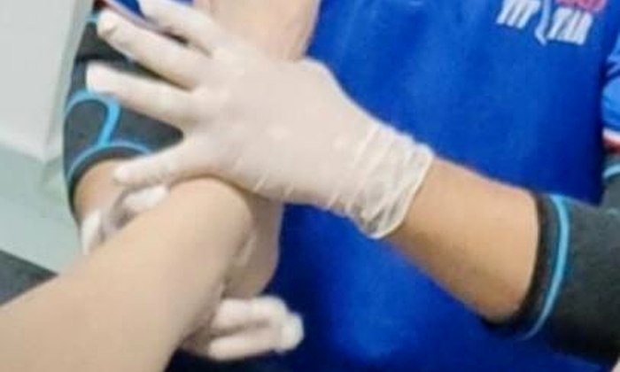 Wrist and hand bone setting at SIFU TIT TAR Singapore